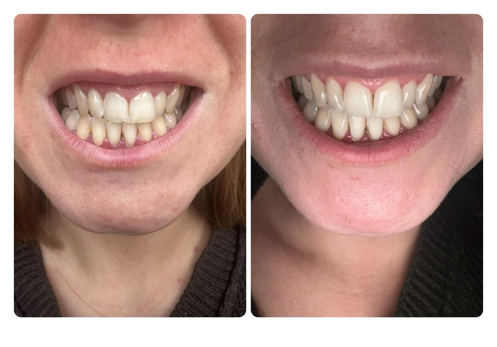 <p>ΧΙΛΙΑΔΕΣ ΙΚΑΝΟΠΟΙΗΜΕΝΑ ΧΑΜΟΓΕΛΑ</p>