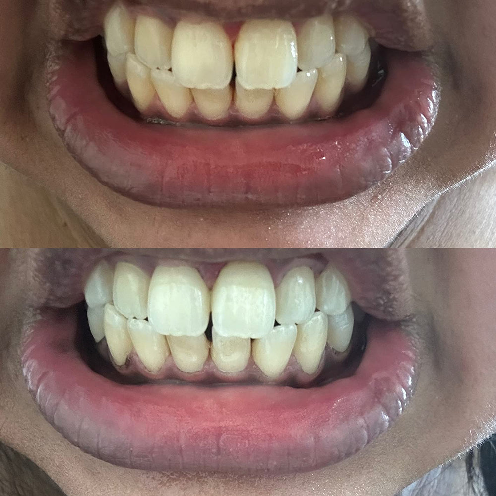 <p>ΧΙΛΙΑΔΕΣ ΙΚΑΝΟΠΟΙΗΜΕΝΑ ΧΑΜΟΓΕΛΑ</p>