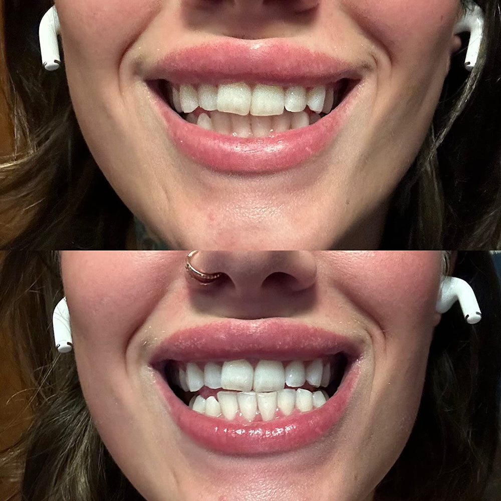 <p>ΧΙΛΙΑΔΕΣ ΙΚΑΝΟΠΟΙΗΜΕΝΑ ΧΑΜΟΓΕΛΑ</p>